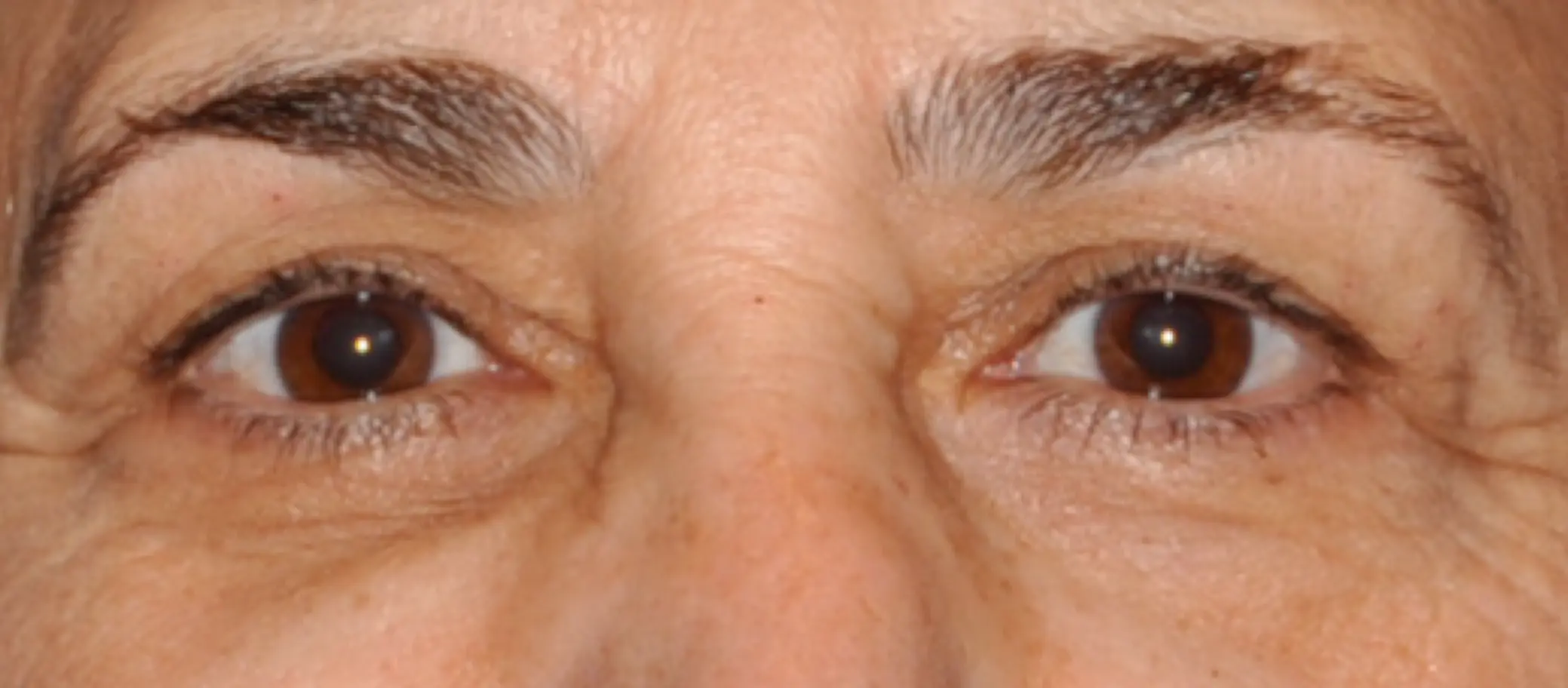 Antes