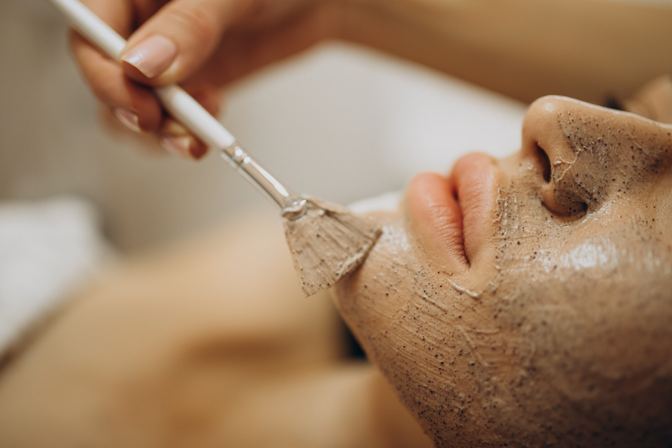 peeling químico